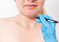 Double Chin Remedy